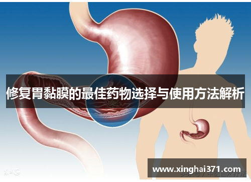 修复胃黏膜的最佳药物选择与使用方法解析
