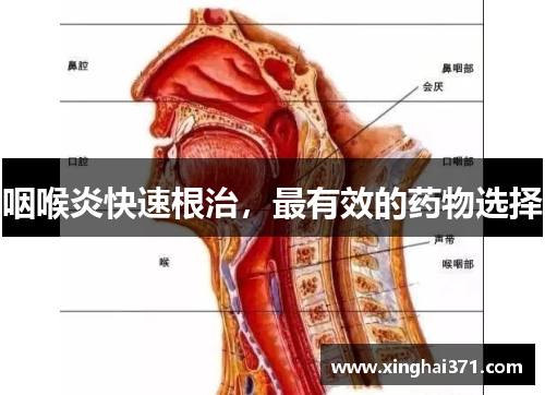 咽喉炎快速根治,最有效的药物选择 咽喉炎快速根治,最有效的药物选择