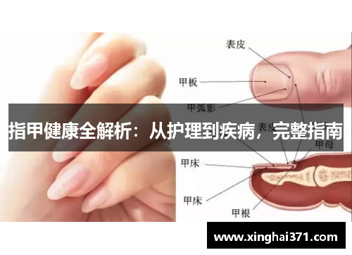 指甲健康全解析:从护理到疾病,完整指南 指甲健康全解析:从护理到疾病,完整指南